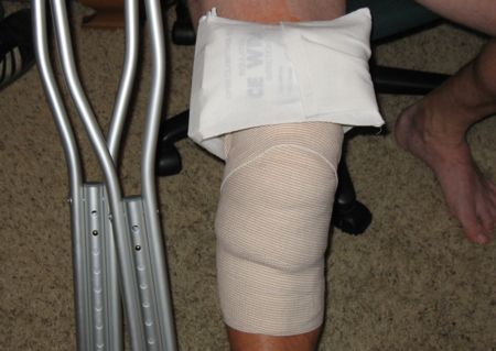 Knee